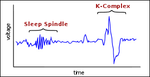 Sleep spindle