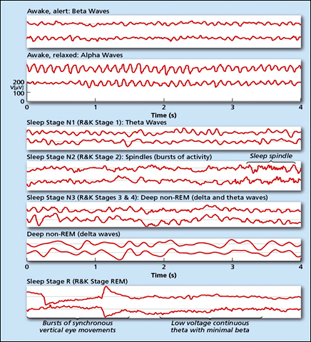 Sleep stages